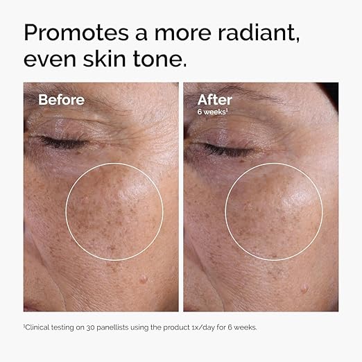 The Ordinary Glycolic Acid 7% Exfoliating Toner, Brightening and Smoothing Daily Toner for More Even-Looking Skin Tone Open Heaven Beauty